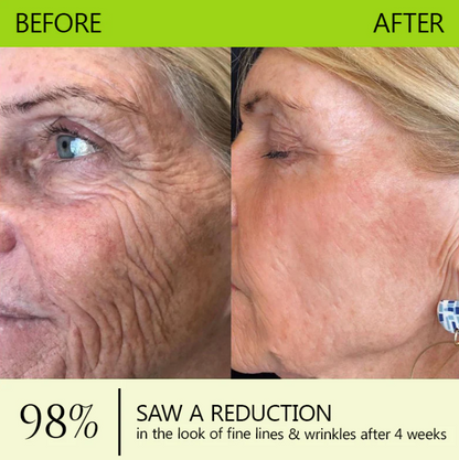 [🔥Last Day 70% OFF] Dobbag™ Botox & Retinol Shot - Eraser for Deep Wrinkles, Sagging Jowls & Puffy Eyes
