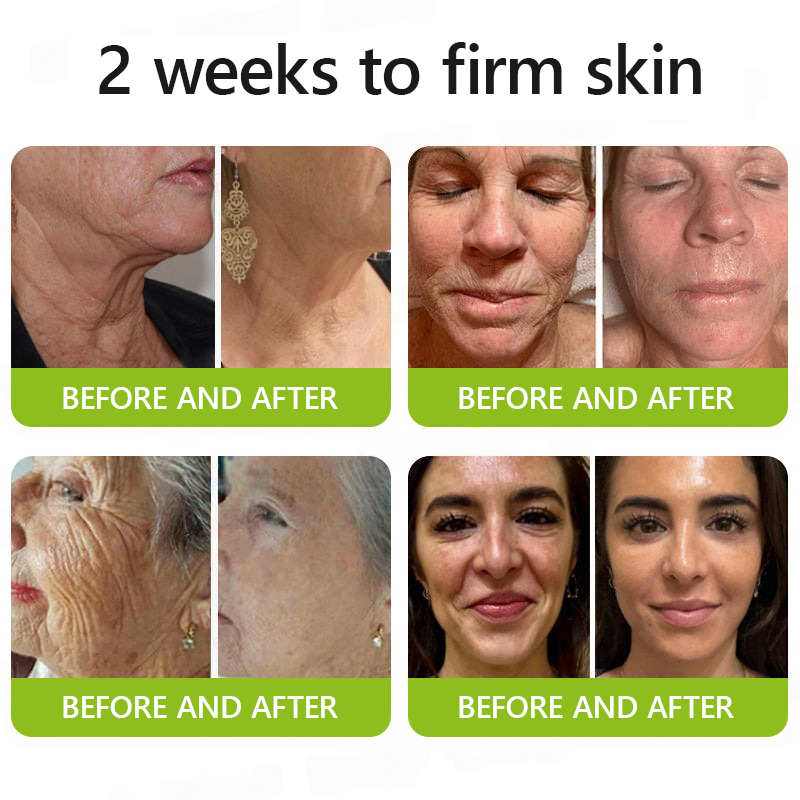 [🔥Last Day 70% OFF] Dobbag™ Botox & Retinol Shot - Eraser for Deep Wrinkles, Sagging Jowls & Puffy Eyes