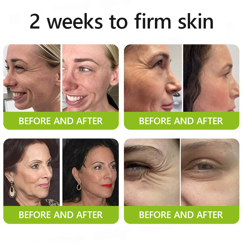 [🔥Last Day 70% OFF] Dobbag™ Botox & Retinol Shot - Eraser for Deep Wrinkles, Sagging Jowls & Puffy Eyes