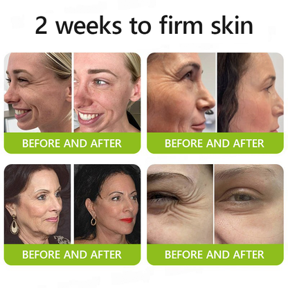 [🔥Last Day 70% OFF] Dobbag™ Botox & Retinol Shot - Eraser for Deep Wrinkles, Sagging Jowls & Puffy Eyes
