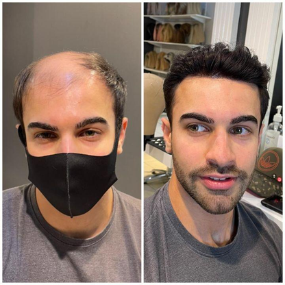 Australia Base: Men's Half Wig | Swiss Lace in Center with Poly skin All Around | Must Have for Traveling