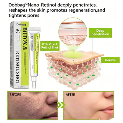[🔥Last Day 70% OFF] Dobbag™ Botox & Retinol Shot - Eraser for Deep Wrinkles, Sagging Jowls & Puffy Eyes